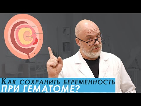 Видео: Действия при ретрохориальной гематоме в первом триместре.