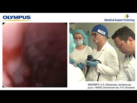 Видео: Уточняющая диагностика патологии пищевода с применением ЭУС. О. А. Малихова