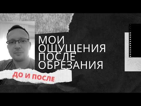 Видео: ✅ Обрезание крайней плоти у мужчин | Мои ощущения ДО и ПОСЛЕ
