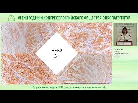 Видео: Определение статуса HER2 при раке желудка   в чем сложность