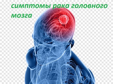 Видео: астроцитома,ответы на коментарии
