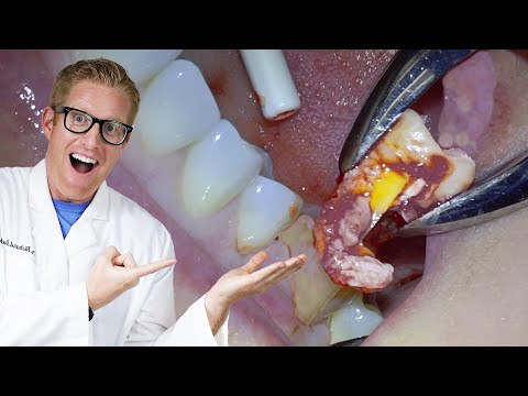 Видео: САМЫЕ БЕЗУМНЫЕ вещи, которые я снимал, будучи стоматологом!!