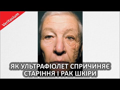 Видео: Як ультрафіолет спричиняє старіння і рак шкіри [Veritasium]