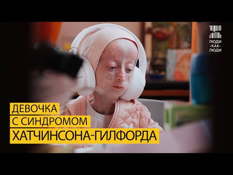 Видео: Таких, как я, 300 человек в мире.