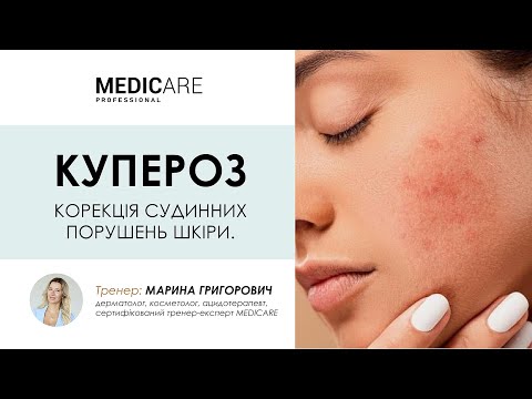 Видео: КУПЕРОЗ. КОРЕКЦІЯ СУДИННИХ ПОРУШЕНЬ ШКІРИ. MEDICARE