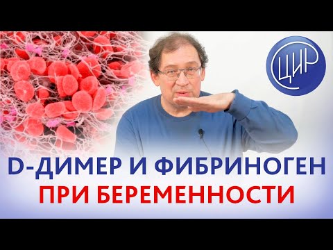 Видео: D-димер и фибриноген при беременности -информативны или нет? Какие показатели гемостаза отслеживать?