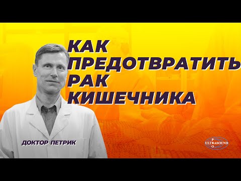 Видео: Как предотвратить рак кишечника.