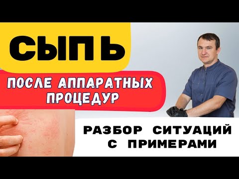 Видео: КЛИЕНТЫ В ПАНИКЕ🤯 СЫПЬ, ЗУД.Что делать, если появилась сыпь после аппаратных процедур? Мнение врача