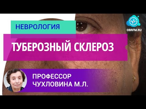 Видео: Профессор Чухловина М.Л.: Туберозный склероз