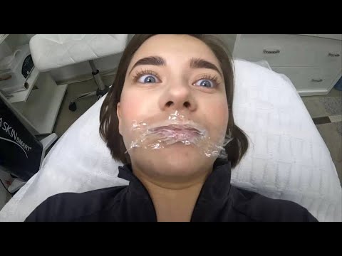 Видео: ПЕРВЫЙ РАЗ УВЕЛИЧИЛА ГУБЫ !!!! РЕАКЦИЯ МУЖА! 😱