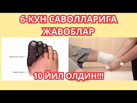 Видео: 6-КУН Саволларига Жавоблар: ДИАБЕТНИ ДАВОЛАШ МАРАФОНИ / ДИАБЕТНИ ДАВОСИ