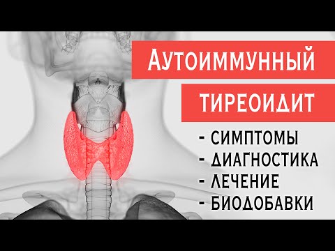 Видео: Аутоиммунный тиреоидит (АИТ, зоб Хашимото): симптомы гипотиреоза, диагностика, лечение, биодобавки.