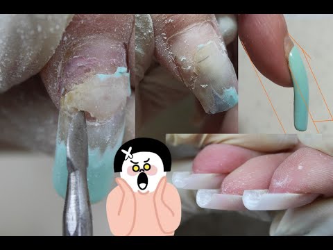 Видео: Полный ШЛАК!!! Моя работа/ Реанимация ногтей/сложная коррекция