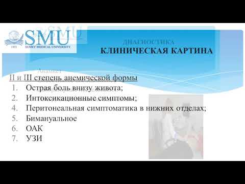 Видео: Апоплексия яичников