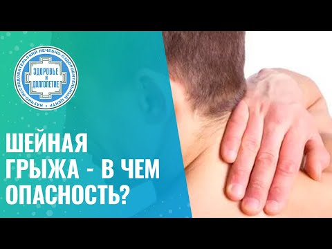 Видео: ​‼️​ Шейная грыжа - в чем опасность?
