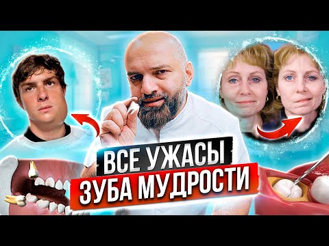 Видео: Зубы мудрости. Что будет после удаления зуба мудрости? Зачем удалять? Как проходит удаление зуба?