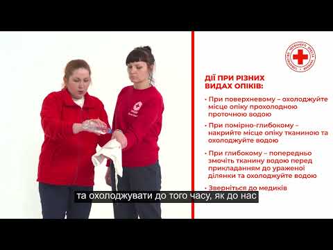 Видео: Перша допомога: опіки