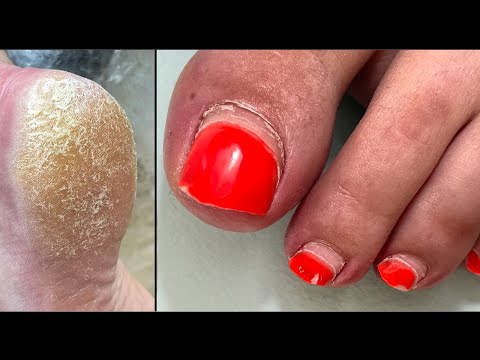 Видео: Неужели всё произошло из-за него 😳/ Педикюр