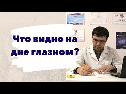 Видео: Что видно на дне глазном? Или немного об офтальмоскопии.