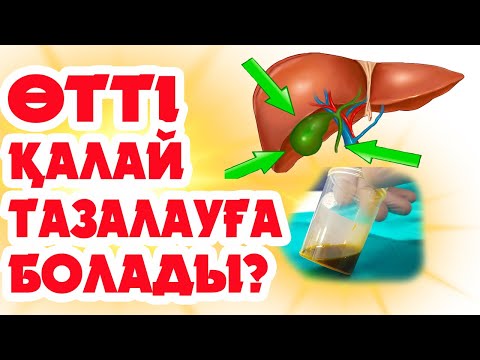 Видео: Өттің толуы. Өт толуының белгілері, себептері, табиғи емдеу жолдары. Бекзат дәрігерден кеңестер.