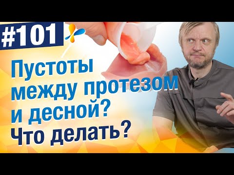 Видео: Что такое перебазировка съемного зубного протеза? Способ убрать пустоты между десной и протезом