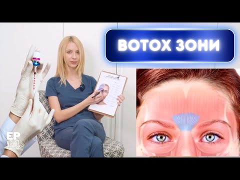 Видео: КЪДЕ и ЗАЩО може да поставим БОТУЛИНОВ ТОКСИН?!