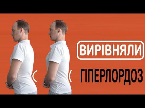 Видео: Випрямляємо Поперековий Лордоз