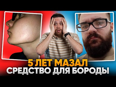 Видео: 5 ЛЕТ со средством для роста бороды / САМЫЙ ИНФОРМАТИВНЫЙ ВЫПУСК!