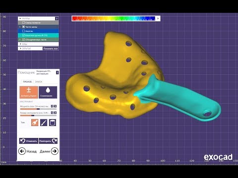 Видео: Exocad Индивидуальная ложка