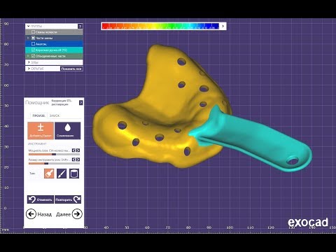 Видео: Exocad Индивидуальная ложка