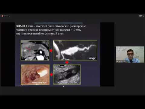 Видео: Скульский С.К. "Значение МРТ в дифферециальной диагностике кистозных неоплазий поджелудочной железы"