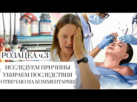 Видео: РОЗАЦЕА ЧАСТЬ 3 || ИЗЛЕЧИМА? ОТВЕЧАЮ НА КОММЕНТАРИИ, ПРИВОЖУ ПРИМЕРЫ || УПРАЖНЕНИЕ В КОНЦЕ ВИДЕО