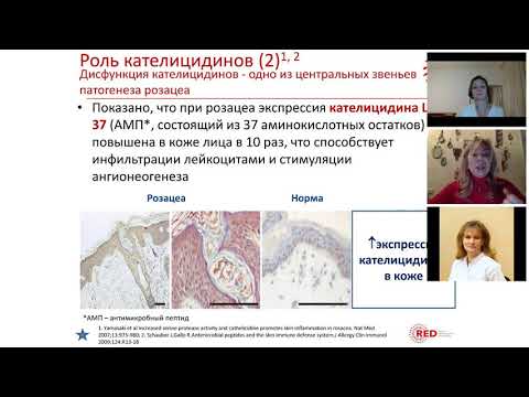 Видео: Розацеа индивидуализированный подход к диагностике и лечению – диалог двух экспертов