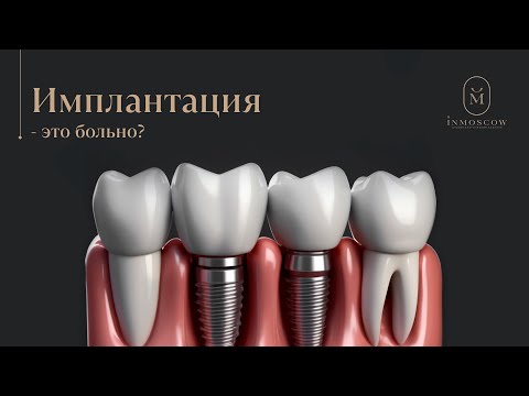 Видео: Больно ли ставить импланты зубов?