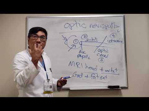 Видео: Локализация оптической нейропатии