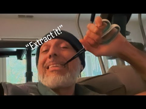 Видео: «Пустая трата денег. Вам следовало бы его удалить», — сказал холистический «стоматолог».