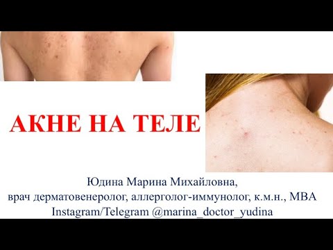 Видео: БЕСПЛАТНО полная лекция по лечению АКНЕ НА ТЕЛЕ (55мин)