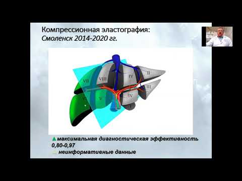 Видео: Эластография печени-неинвазивный метод оценки фиброза (Борсуков А.В.)