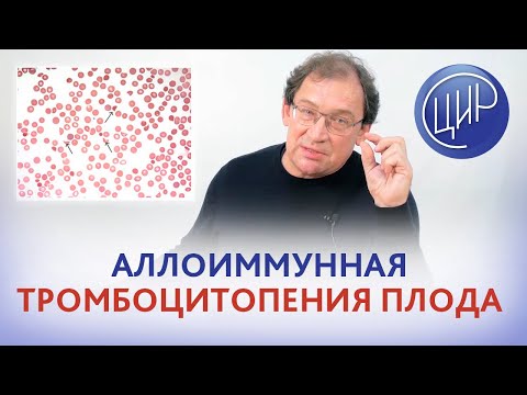 Видео: Гены ITGА2 и ITGB3, группы крови тромбоцитов и аллоиммунная тромбоцитопения плода. И.И. Гузов.
