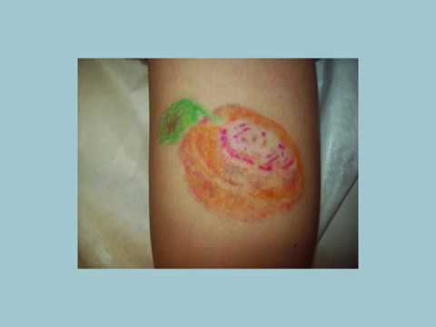 Видео: Волдыри после лазерного удаления татуировок.