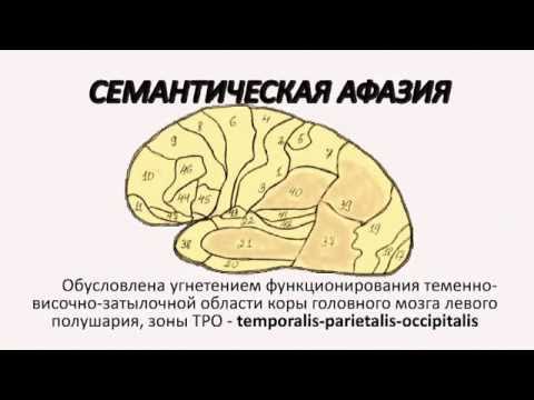 Видео: Семантическая афазия. Практическая часть.