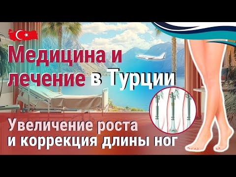 Видео: Увеличение роста и коррекция ног в Турции: Медицина, меняющая жизнь!