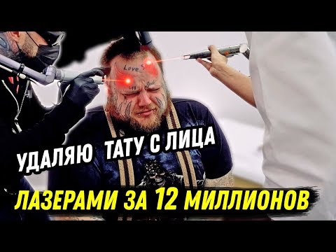 Видео: УДАЛЯЮ ТАТУ С ЛИЦА САМЫМ МОЩНЫМ ЛАЗЕРОМ В МИРЕ !