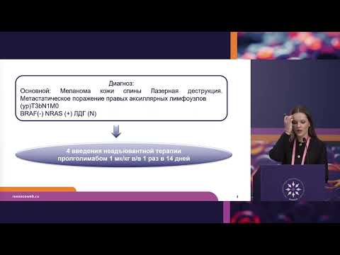 Видео: Презентация клинического случая пациента с меланомой кожи