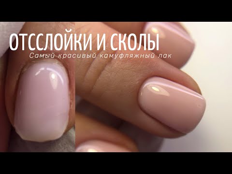 Видео: Отслойки и сколы на ногтях