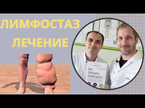 Видео: Лимфостаз лечение. Флеболог Москва.