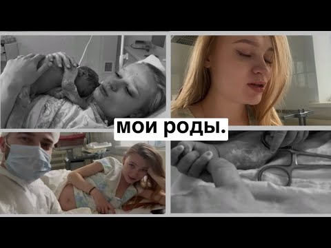 Видео: ВЛОГ: Я РОДИЛА ! 🤍 ПАРНЫЕ РОДЫ!