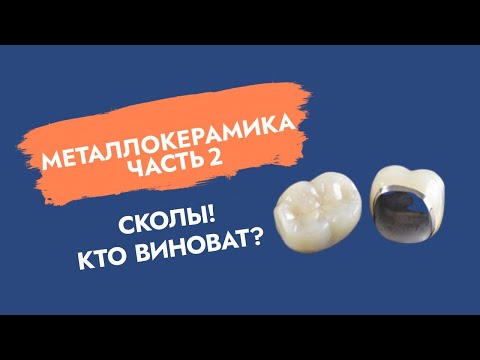 Видео: Металлокерамика (ч.2). Сколы. Кто виноват?