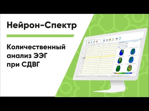 Видео: Методы количественного анализа ЭЭГ при диагностике СДВГ в программе «Нейрон-Спектр.NET»