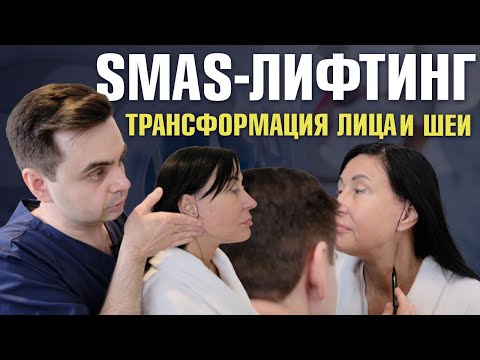 Видео: SMAS-лифтинг лица и шеи: Реальный результат спустя 2 недели и 2 месяца!